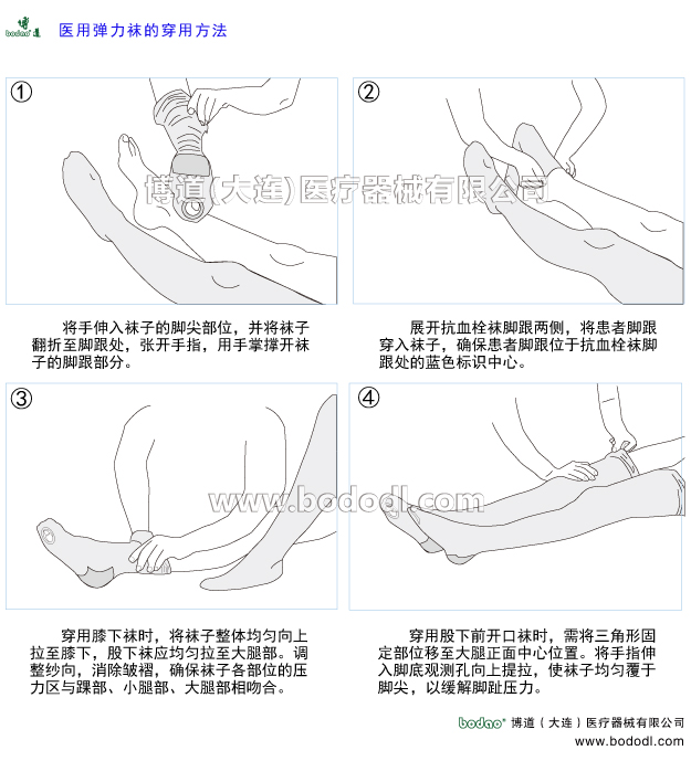 深静脉血栓形成的预防与护理