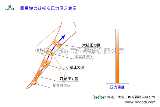 静脉曲张的预防与治疗