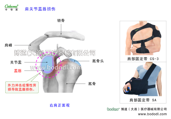 肩关节的运动损伤与防护