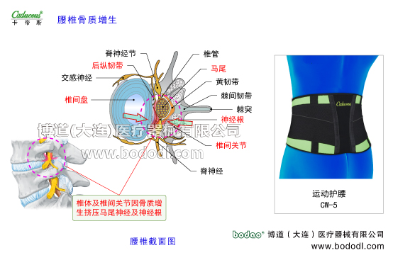 腰椎部的运动损伤与防护