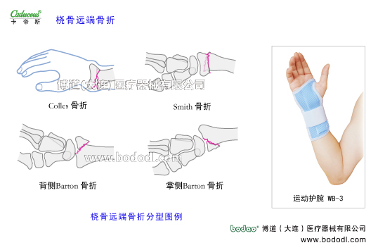 腕关节的运动损伤与防护