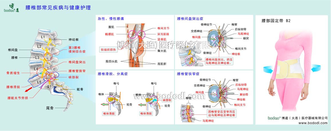 COMMON DISEASES OF LUMBAR SPINE
