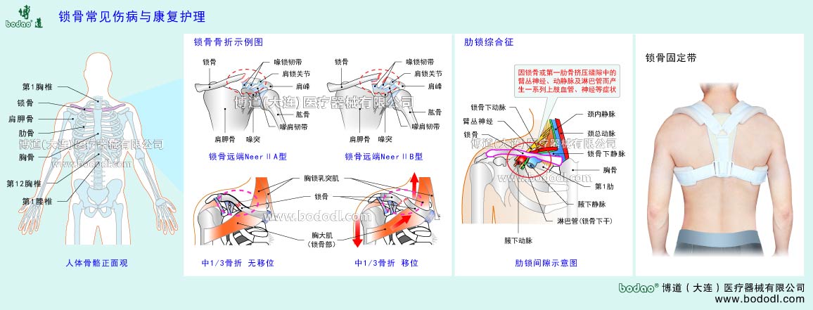COMMON DISEASES OF CLAVICLE 